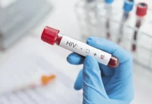 Sudáfrica producirá nuevo tratamiento contra el VIH para ampliar acceso en África