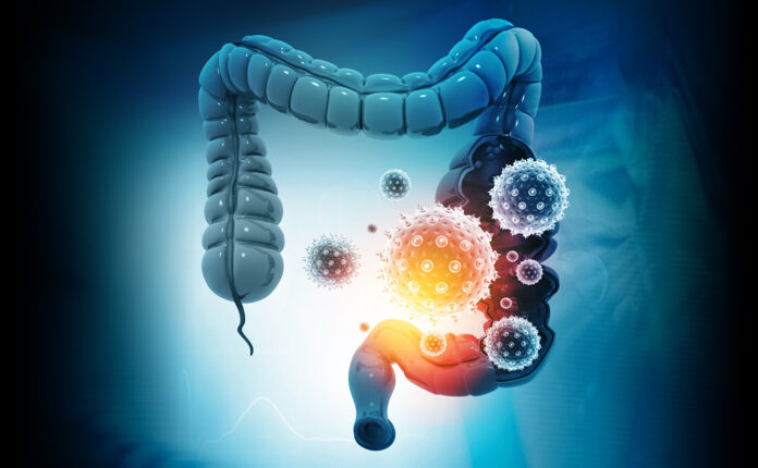 colorectal-cancer-screening-mcg