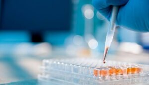Medicamento experimental contra la psicosis asociada al Alzheimer no alcanza el objetivo principal de un ensayo