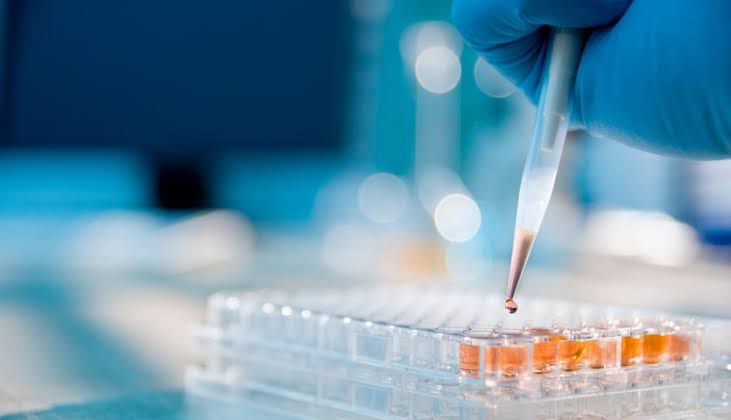 Medicamento experimental contra la psicosis asociada al Alzheimer no alcanza el objetivo principal de un ensayo